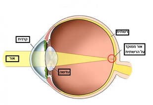 חתך מבנה העין - הרשתית, הקרנית, עדשת העין